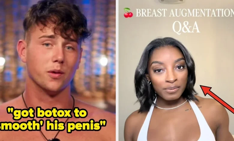 32 Famous People Talk Plastic Surgery