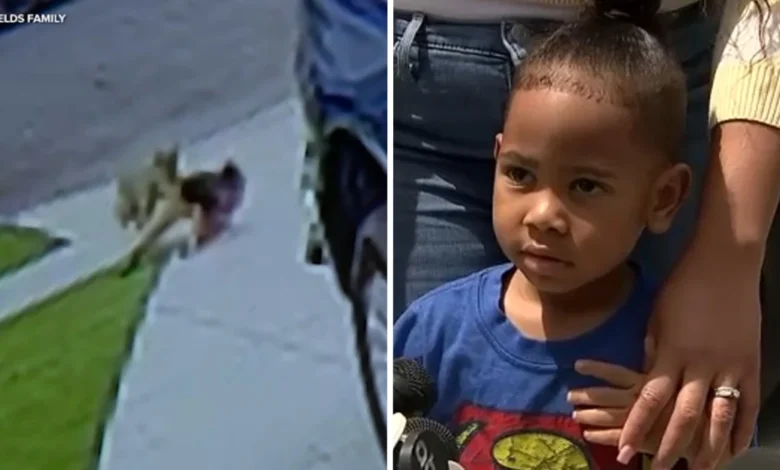 4-year-old boy attacked by coyote while standing in grandparents' driveway in Carson