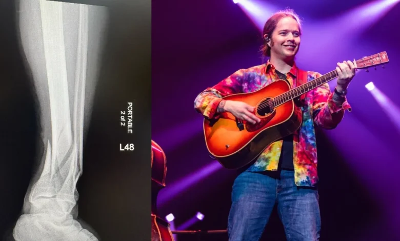 Billy Strings Breaks A Leg In Charlottesville