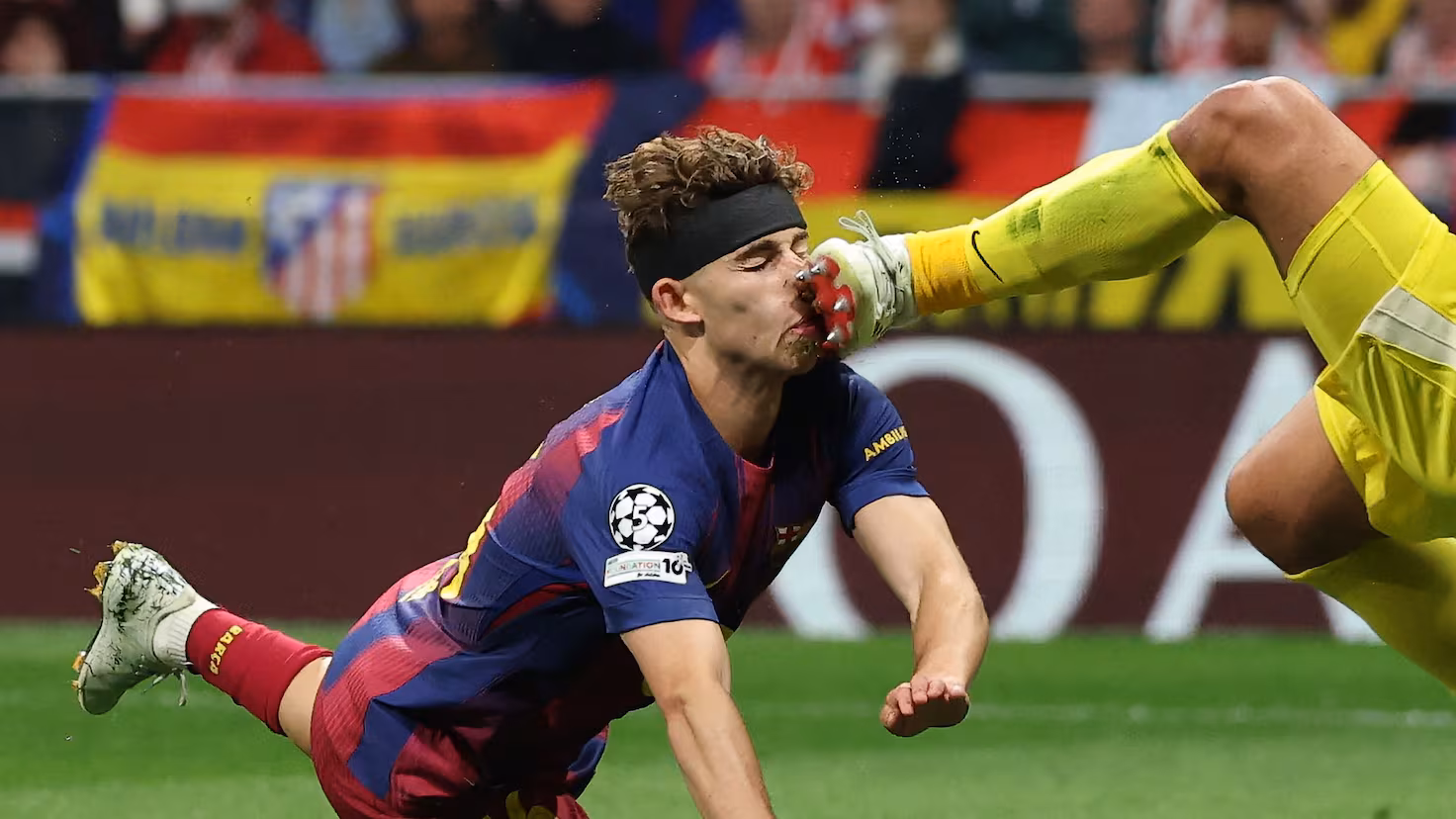 Brutal choque de Fermín con Musso