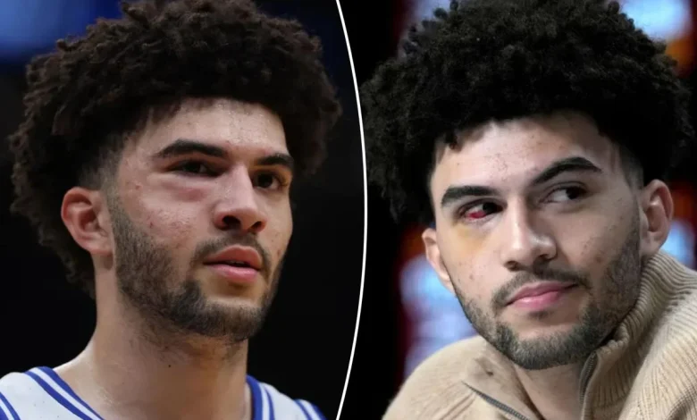 Cameron Boozer suffered multiple facial fractures in loss to UConn