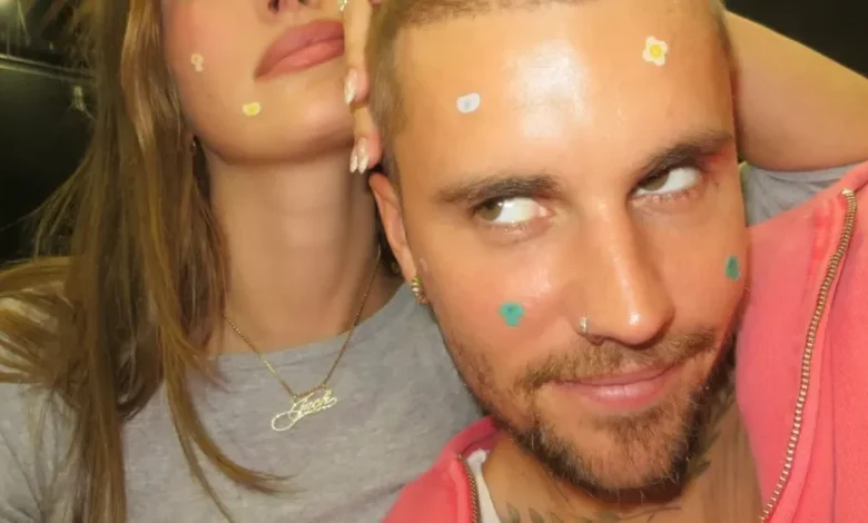 EXCLUSIVE: Why Hailey and Justin Bieber Collaborated on Rhode’s Pimple Stickers