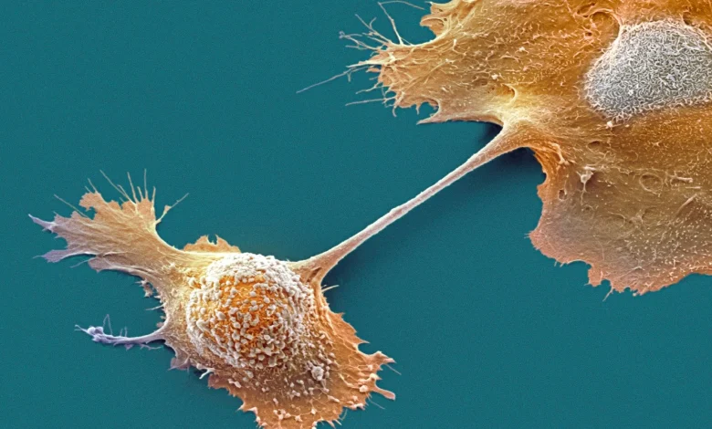 Experimental drug doubles one-year survival in pancreatic cancer