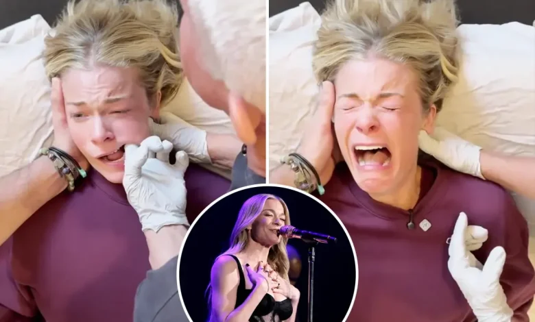 Experts weigh in on LeAnn Rimes’ emotional reaction to jaw release therapy: ‘Sympathetic response’