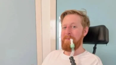 Michael Patrick of 'Game of Thrones' Dies at 35. Motor Neuron Disease, Explained