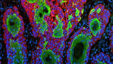 Replimune skin cancer drug that became FDA flashpoint is rejected again