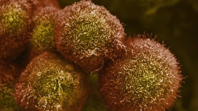 Revolution Medicines touts success in pancreatic cancer treatment