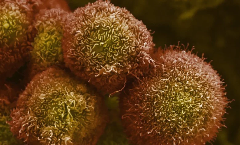 Revolution Medicines touts success in pancreatic cancer treatment