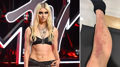 Taylor Momsen rushed to hospital after venomous spider bite during AC/DC tour