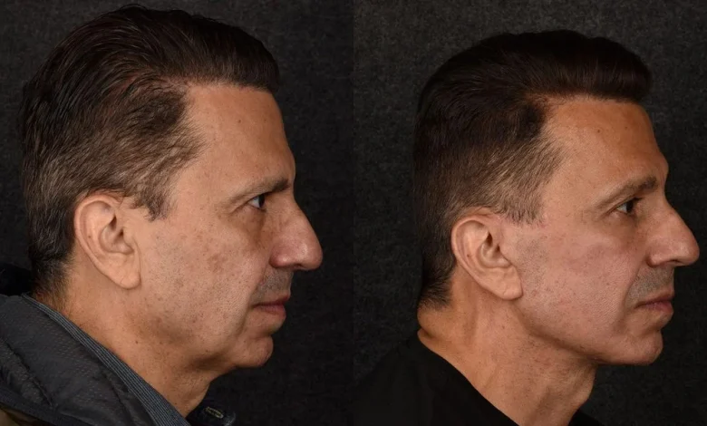 The C-Suite Is Paying Big Money to Look Approachable, Less Irritable