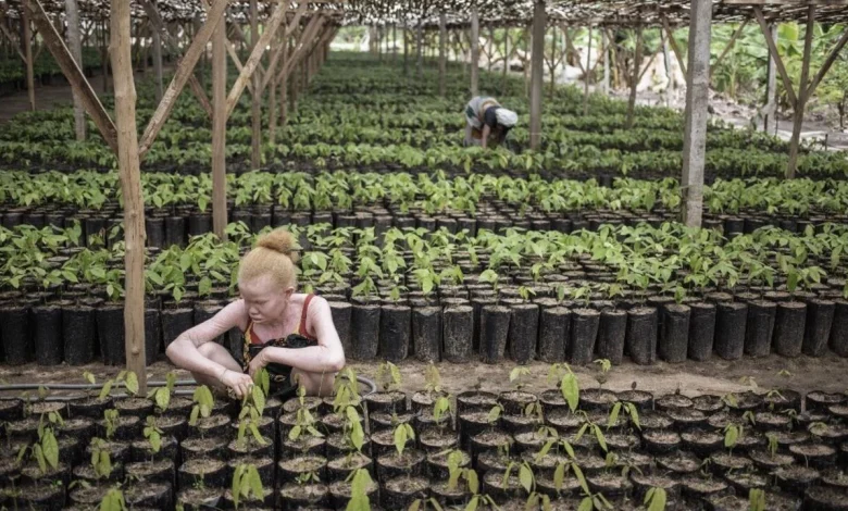 À Madagascar, une série d’attaques contre des personnes albinos ravive la peur