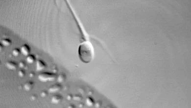 Anti-Aging Millionaire Announces He Has Split Back Into Sperm And Egg