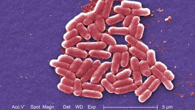 County Reports Two Local Cases in Statewide Kebab Shop E.Coli Outbreak  | News