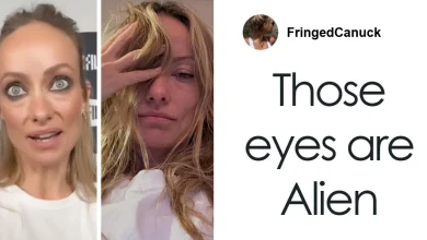 Doctors Suggest Cause Of Olivia Wilde's Recent Transformation After She Was Compared To Gollum