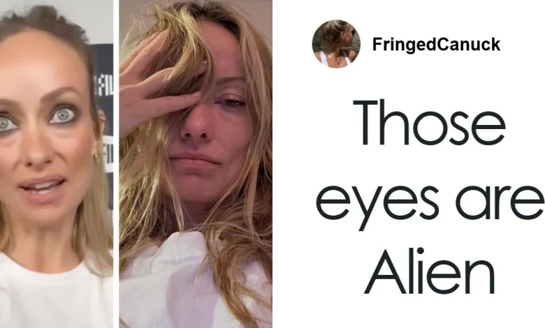 Doctors Suggest Cause Of Olivia Wilde's Recent Transformation After She Was Compared To Gollum