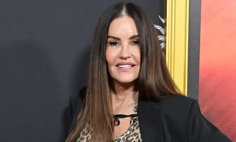 Former supermodel Janice Dickinson unveils dramatic results of facelift at 71