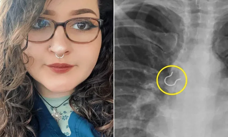 Woman Thought Her Extreme Cough Was Due to Dog Hair. It Was Actually from Inhaling Her Own Nose Piercing