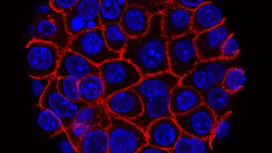 Combo of pancreatic cancer drugs leads to strong response rate