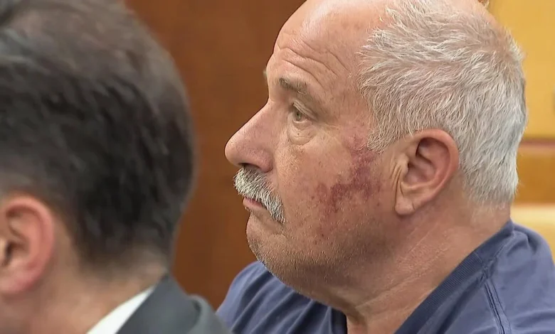 Hopkinton, Massachusetts man charged with attempted murder in beach fight video freed on bail