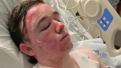 McDonald’s worker suffers severe burns on face and body after coworker throws hot oil on him, family says