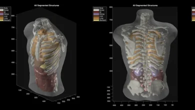 Midjourney goes from generating cat images to full-body ultrasound scans