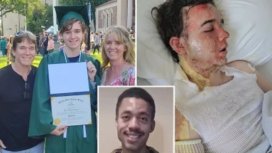 Yuba City McDonald’s boss rushed to ICU with horrific injuries after colleague threw scorching hot oil over him