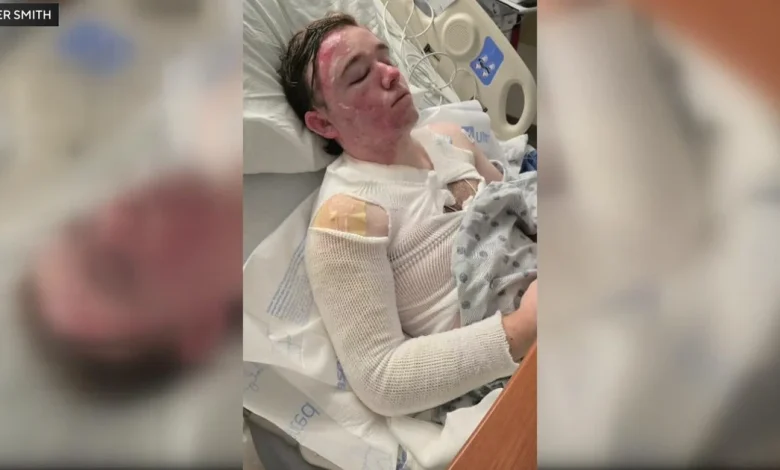 Yuba City McDonald's employee hospitalized after coworker threw hot oil on him, police say